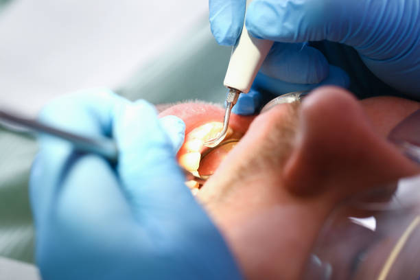 Best Urgent Care for Lost Fillings or Crowns in West Freehold, NJ
